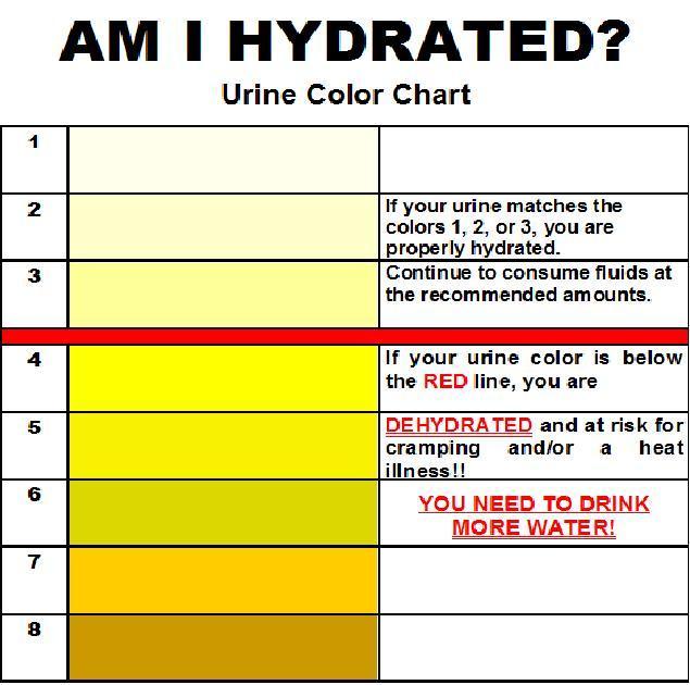 Color of the urine.